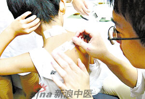 灸法的種類  你知道多少？